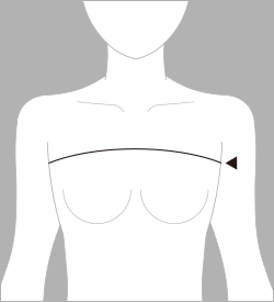 上胸囲
